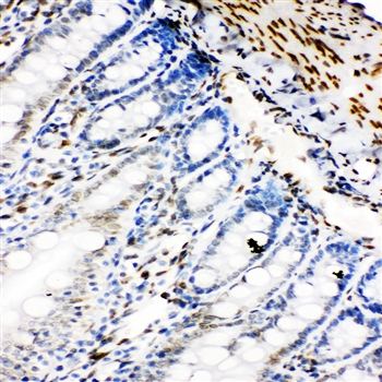 Lamin B2/LMNB2 Rabbit Polyclonal Antibody