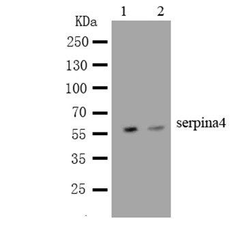 Kallistatin/SERPINA4 Rabbit Polyclonal Antibody