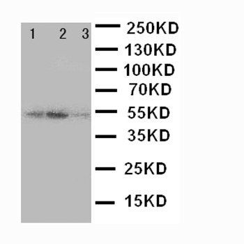 Kallistatin/SERPINA4 Rabbit Polyclonal Antibody