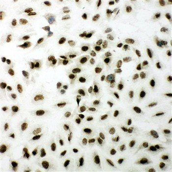 XRCC1 Rabbit Polyclonal Antibody