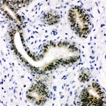 XRCC1 Rabbit Polyclonal Antibody