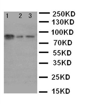 XRCC1 Rabbit Polyclonal Antibody