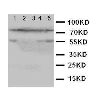 5 Lipoxygenase/ALOX5 Rabbit Polyclonal Antibody