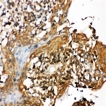 CIAS1/NALP3/NLRP3 Rabbit Polyclonal Antibody