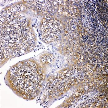 NOX2/gp91phox/CYBB Rabbit Polyclonal Antibody
