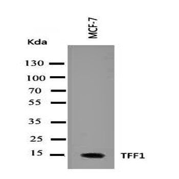 Estrogen Inducible Protein pS2/TFF1 Rabbit Polyclonal Antibody