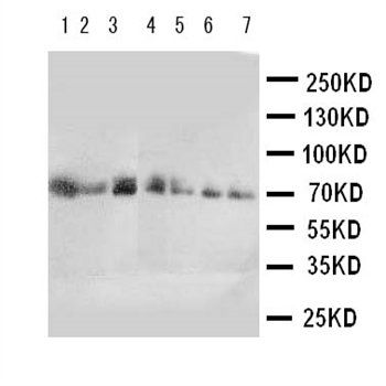 CYP11B1 Rabbit Polyclonal Antibody