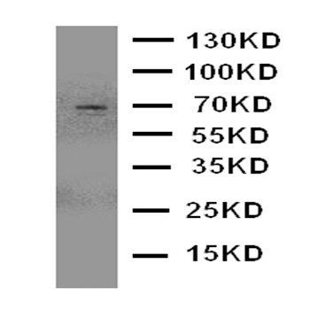 Serotonin transporter/SLC6A4 Rabbit Polyclonal Antibody
