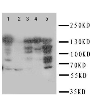 Replication factor C subunit 1 RFC1 Rabbit Polyclonal Antibody