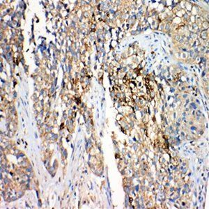 Hydroxysteroid Dehydrogenase 4/HSD17B4 Rabbit Polyclonal Antibody