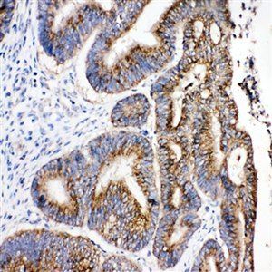 Hydroxysteroid Dehydrogenase 4/HSD17B4 Rabbit Polyclonal Antibody