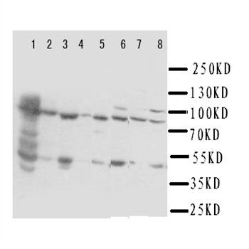 Hydroxysteroid Dehydrogenase 4/HSD17B4 Rabbit Polyclonal Antibody