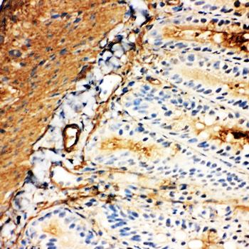 Glucose Transporter 5 GLUT5/SLC2A5 Rabbit Polyclonal Antibody