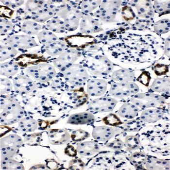 Aquaporin 2/AQP2 Rabbit Polyclonal Antibody