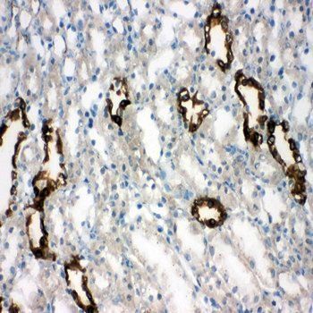 Aquaporin 2/AQP2 Rabbit Polyclonal Antibody