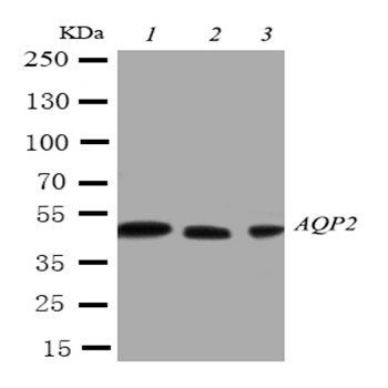 Aquaporin 2/AQP2 Rabbit Polyclonal Antibody