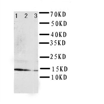 Interleukin-4 IL4 Rabbit Polyclonal Antibody