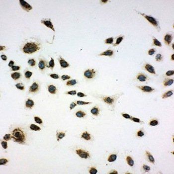 SIAH Interacting Protein/CACYBP Rabbit Polyclonal Antibody