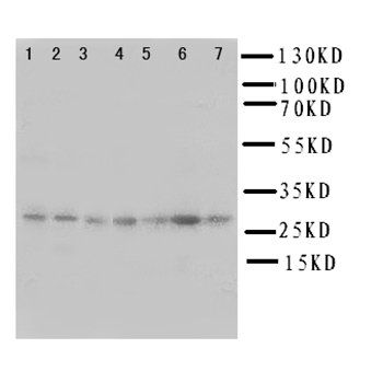 SIAH Interacting Protein/CACYBP Rabbit Polyclonal Antibody