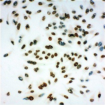 MCM6 Rabbit Polyclonal Antibody