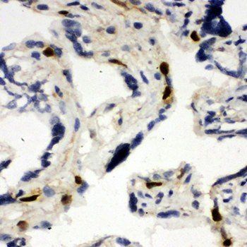 MCM6 Rabbit Polyclonal Antibody