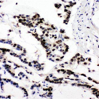 MCM6 Rabbit Polyclonal Antibody