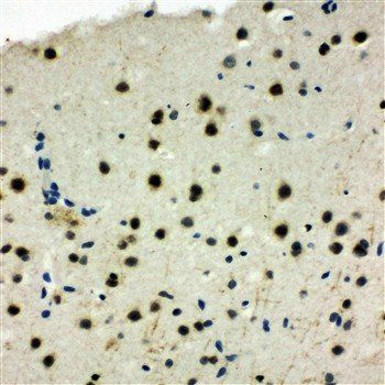 MCM6 Rabbit Polyclonal Antibody