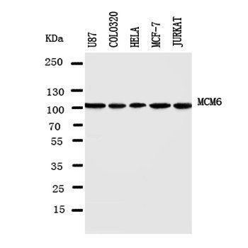 MCM6 Rabbit Polyclonal Antibody