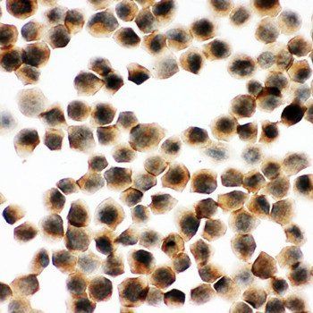 SNAP23 Rabbit Polyclonal Antibody
