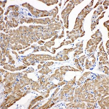 cardiac Troponin C/TNNC1 Rabbit Polyclonal Antibody