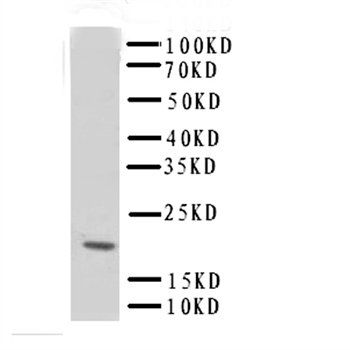 cardiac Troponin C/TNNC1 Rabbit Polyclonal Antibody