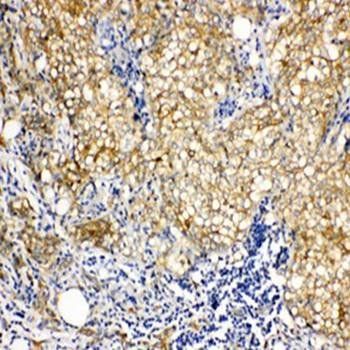 Vinculin/VCL Rabbit Polyclonal Antibody