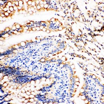 Vinculin/VCL Rabbit Polyclonal Antibody