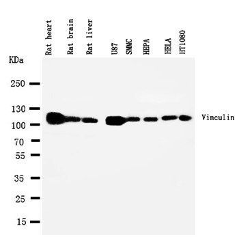 Vinculin/VCL Rabbit Polyclonal Antibody