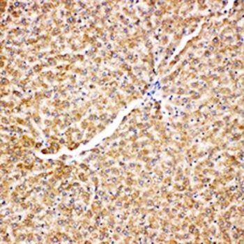 Grp75/HSPA9 Rabbit Polyclonal Antibody