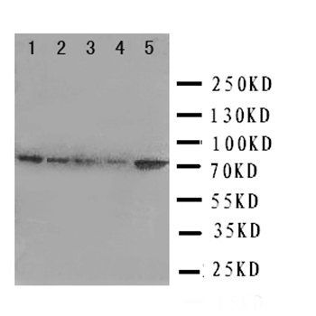 Grp75/HSPA9 Rabbit Polyclonal Antibody
