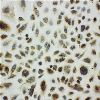 Cpn10/HSPE1 Rabbit Polyclonal Antibody