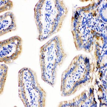 Cpn10/HSPE1 Rabbit Polyclonal Antibody