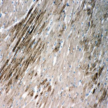 Heat shock protein beta-2 HSPB2 Rabbit Polyclonal Antibody