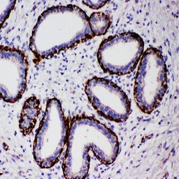 Arginase-2, mitochondrial Arg2 Rabbit Polyclonal Antibody