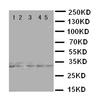 Transcription factor E2F6 E2F6 Rabbit Polyclonal Antibody