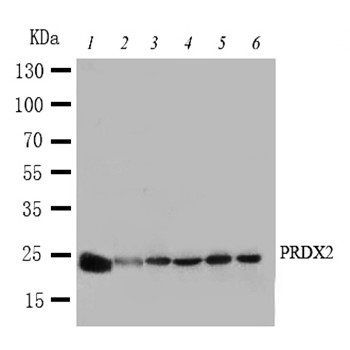 Peroxiredoxin 2/PRDX2 Rabbit Polyclonal Antibody