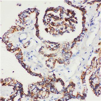 Peroxiredoxin 5/PRDX5 Rabbit Polyclonal Antibody