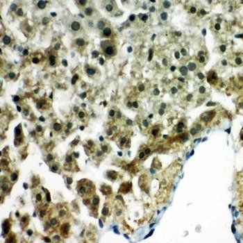 Peroxiredoxin 5/PRDX5 Rabbit Polyclonal Antibody