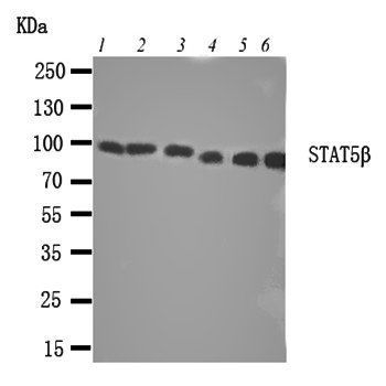 STAT5b Rabbit Polyclonal Antibody