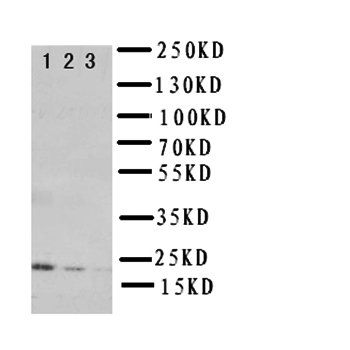 Interleukin-10 IL10/10 Rabbit Polyclonal Antibody