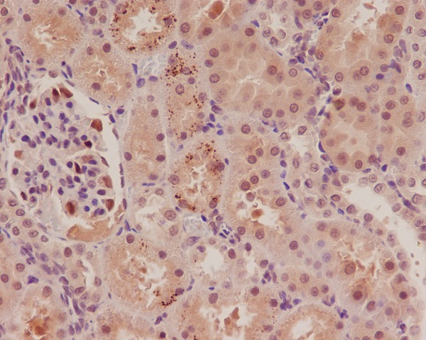 p57 Kip2 Rabbit Monoclonal Antibody