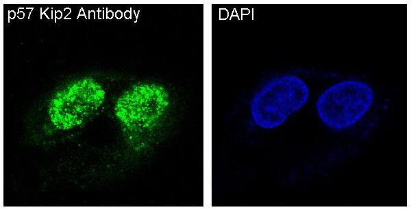 p57 Kip2 Rabbit Monoclonal Antibody