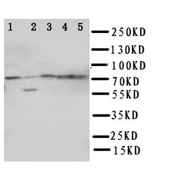ABCG1 Rabbit Polyclonal Antibody