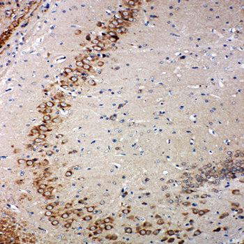 Glutaredoxin 2/GLRX2 Rabbit Polyclonal Antibody